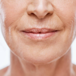 Smoker’s Lines and Thin Lips: How Lip Injections Can Restore a Youthful Look in Miami