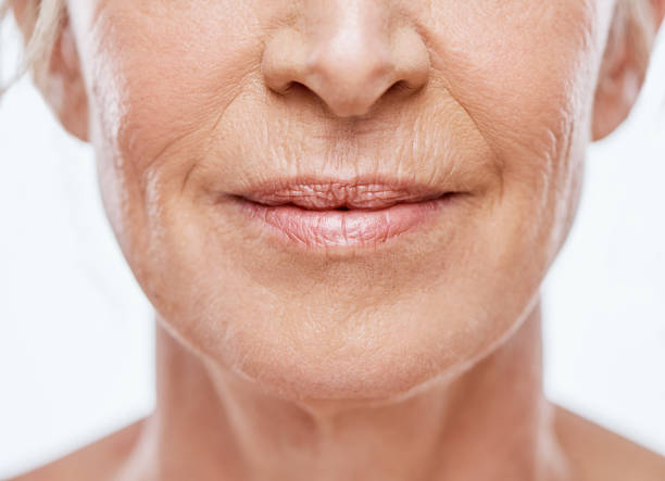 Smoker’s Lines and Thin Lips: How Lip Injections Can Restore a Youthful Look in Miami